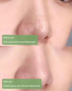 🌿 Máscara em bastão de argila com chá verde natural Serenya™ – Limpa acne e refina os poros