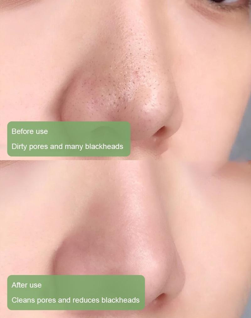 🌿 Máscara em bastão de argila com chá verde natural Serenya™ – Limpa acne e refina os poros